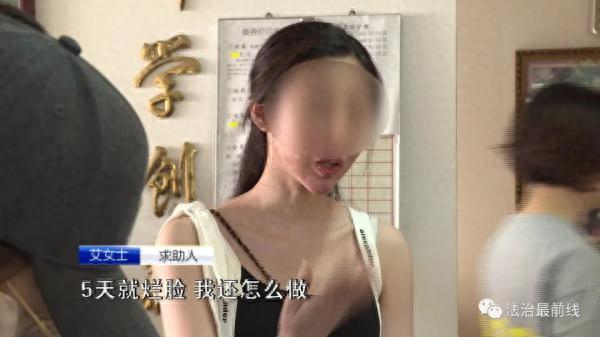 广西20岁美女祛痘不成反“烂脸”要索赔！美容院：放弃治疗后果自负