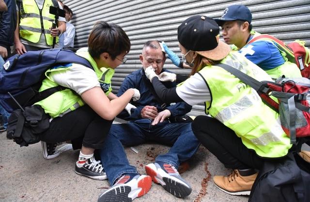 日本游客香港街头遭袭 日网友炸了：这不是暴行是什么