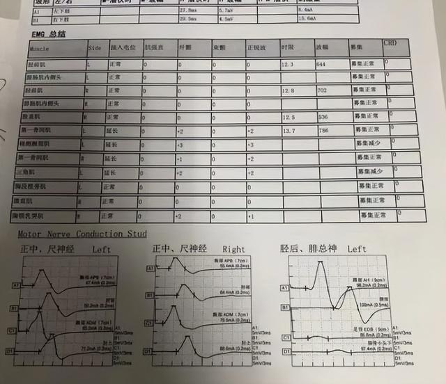 小伙辞职带渐冻症母亲自驾游新疆，15000公里旅行后，决定捐遗体