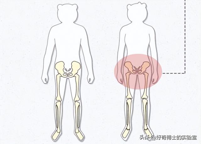 为啥女生的屁股两侧，会凹进去？