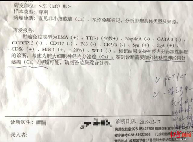 看哭了！28岁女子光头出镜记录抗癌过程，希望大家重视健康